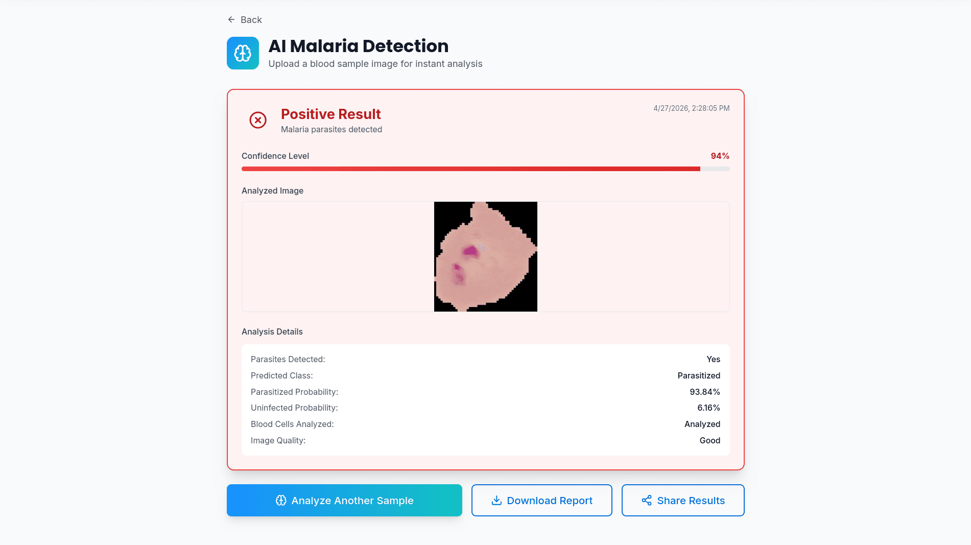Malaria Detection System challenge illustration